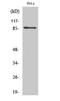 UTP14A Small Subunit Processome Component antibody, A11298, Boster Biological Technology, Western Blot image 