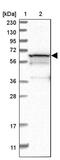 Phosphoglucomutase-1 antibody, PA5-55132, Invitrogen Antibodies, Western Blot image 