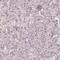 DEK Proto-Oncogene antibody, HPA054505, Atlas Antibodies, Immunohistochemistry frozen image 