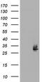 N-Ribosyldihydronicotinamide:Quinone Reductase 2 antibody, TA504744, Origene, Western Blot image 
