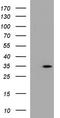 Ankyrin Repeat Domain 49 antibody, TA507228S, Origene, Western Blot image 