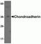 Chondroadherin antibody, NBP2-81809, Novus Biologicals, Western Blot image 