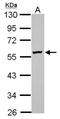 Diphthamide Biosynthesis 2 antibody, NBP2-16219, Novus Biologicals, Western Blot image 