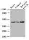 Zinc Finger Protein 707 antibody, A62002-100, Epigentek, Western Blot image 