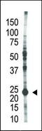 Ubiquitin-conjugating enzyme E2 S antibody, TA302237, Origene, Western Blot image 