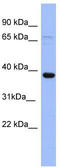 Immediate Early Response 5 antibody, TA345011, Origene, Western Blot image 