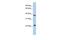 DEAD-Box Helicase 25 antibody, GTX47518, GeneTex, Western Blot image 