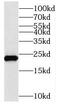 Nudix Hydrolase 10 antibody, FNab05898, FineTest, Western Blot image 