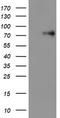 LIM Domain Kinase 1 antibody, CF502978, Origene, Western Blot image 