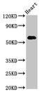 Natural resistance-associated macrophage protein 1 antibody, CSB-PA021380LA01HU, Cusabio, Western Blot image 