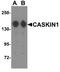 CASK Interacting Protein 1 antibody, A13631, Boster Biological Technology, Western Blot image 
