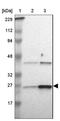 Adenylate kinase isoenzyme 1 antibody, NBP1-87401, Novus Biologicals, Western Blot image 