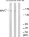 ATP Binding Cassette Subfamily C Member 10 antibody, TA315963, Origene, Western Blot image 