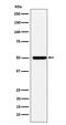 4-Aminobutyrate Aminotransferase antibody, M07133-2, Boster Biological Technology, Western Blot image 