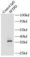 Pulmonary surfactant-associated protein D antibody, FNab08401, FineTest, Immunoprecipitation image 