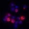 Interleukin 4 Receptor antibody, AF6844, R&D Systems, Immunocytochemistry image 