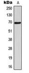 5'-Nucleotidase, Cytosolic IB antibody, LS-C354230, Lifespan Biosciences, Western Blot image 