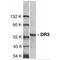 TNF Receptor Superfamily Member 25 antibody, TA305965, Origene, Western Blot image 
