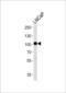 Membrane Metalloendopeptidase antibody, LS-C164228, Lifespan Biosciences, Western Blot image 