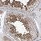 SOGA Family Member 3 antibody, NBP1-90575, Novus Biologicals, Immunohistochemistry frozen image 