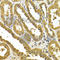 UDP Glucuronosyltransferase Family 1 Member A4 antibody, A5549, ABclonal Technology, Immunohistochemistry paraffin image 