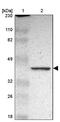 Family With Sequence Similarity 199, X-Linked antibody, PA5-51823, Invitrogen Antibodies, Western Blot image 