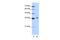 Exosome Component 7 antibody, PA5-41854, Invitrogen Antibodies, Western Blot image 