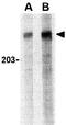 Cullin 9 antibody, GTX85085, GeneTex, Western Blot image 