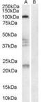 Reticulon 4 Receptor antibody, NB100-1536, Novus Biologicals, Western Blot image 