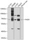 Peptidyl Arginine Deiminase 1 antibody, 13-459, ProSci, Western Blot image 