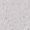 Leucine Rich Repeat Containing 14B antibody, HPA038047, Atlas Antibodies, Immunohistochemistry paraffin image 