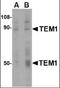 CD248 Molecule antibody, orb88395, Biorbyt, Western Blot image 