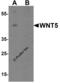 Wnt Family Member 5B antibody, 8063, ProSci, Western Blot image 