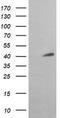 3-ketoacyl-CoA thiolase, mitochondrial antibody, TA506156, Origene, Western Blot image 