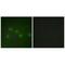 Nuclear Receptor Subfamily 2 Group F Member 2 antibody, A02420, Boster Biological Technology, Immunofluorescence image 