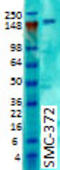 Contactin Associated Protein Like 2 antibody, TA326393, Origene, Western Blot image 