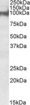 NDRG Family Member 2 antibody, 42-420, ProSci, Western Blot image 