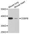 CCAAT Enhancer Binding Protein Beta antibody, STJ111016, St John