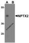 NP2 antibody, 4573, ProSci Inc, Western Blot image 
