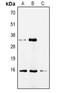 Cytidine deaminase antibody, LS-B16496, Lifespan Biosciences, Western Blot image 