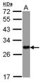 Tyrosine 3-Monooxygenase/Tryptophan 5-Monooxygenase Activation Protein Eta antibody, NBP2-21586, Novus Biologicals, Western Blot image 