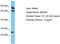 VPS26 Endosomal Protein Sorting Factor C antibody, TA330298, Origene, Western Blot image 