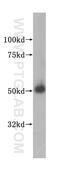 Malonyl-CoA decarboxylase, mitochondrial antibody, 15265-1-AP, Proteintech Group, Western Blot image 