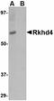 Mex-3 RNA Binding Family Member A antibody, orb75088, Biorbyt, Western Blot image 