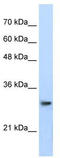 Proteasome Subunit Alpha 1 antibody, TA345809, Origene, Western Blot image 