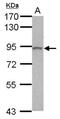 Phospholipase C Delta 3 antibody, NBP2-19862, Novus Biologicals, Western Blot image 