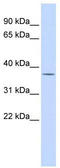 Poly(ADP-Ribose) Polymerase Family Member 16 antibody, TA334257, Origene, Western Blot image 