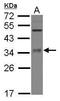 Methyltransferase Like 6 antibody, GTX121980, GeneTex, Western Blot image 