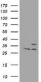Proteasome Subunit Beta 7 antibody, TA504456S, Origene, Western Blot image 