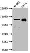 Nucleoporin 98 antibody, CSB-RA995655A0HU, Cusabio, Western Blot image 